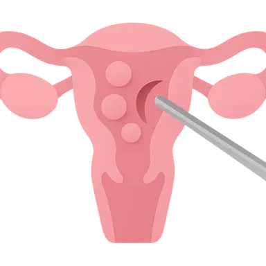 Myomectomy procedures