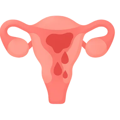 Abnormal Uterine Bleeding: Classification