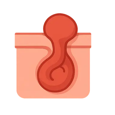 Incarcerated/strangulated hernias