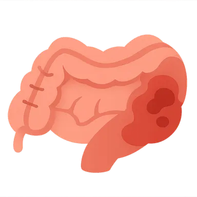 Necrotizing enterocolitis surgical management