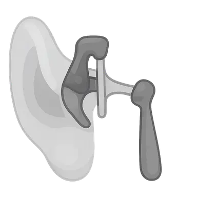 Ossicular Chain Reconstruction