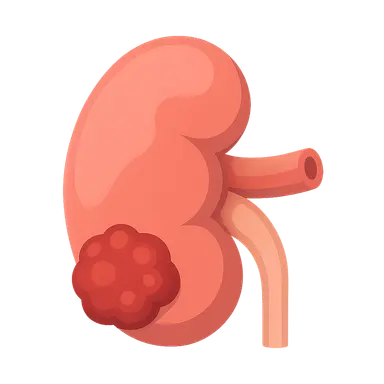 Renal tumors
