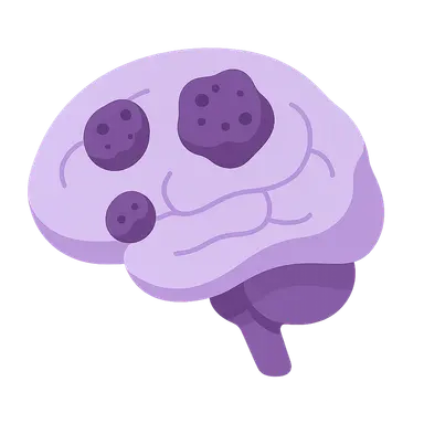 Metastatic CNS tumors