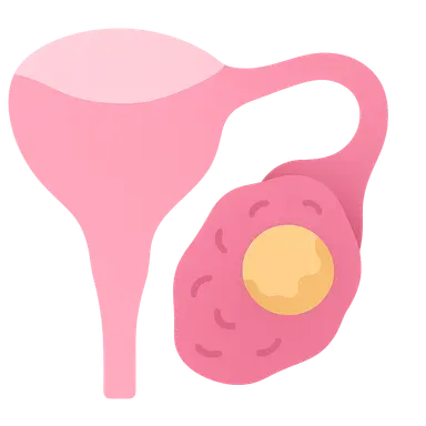 Ovulatory Disorders