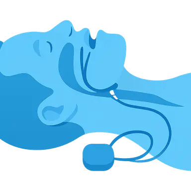 Upper Airway Stimulation Therapy
