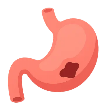 Gastrointestinal perforation