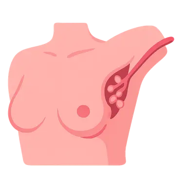 Axillary lymph node dissection