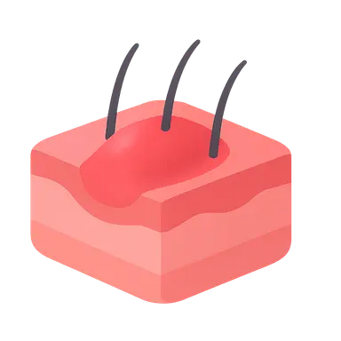 Patterns of inflammatory response