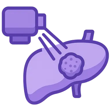 Intensity-Modulated Radiation Therapy