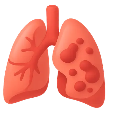 Acute respiratory distress syndrome