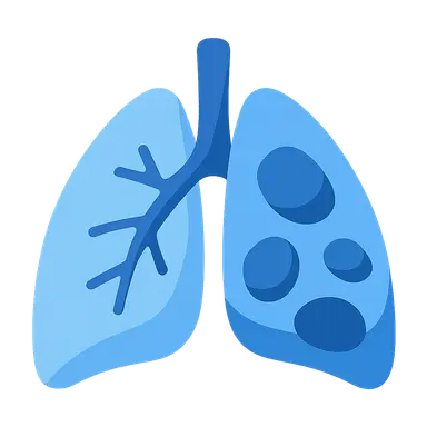 V/Q mismatch in ARDS