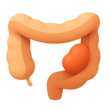 Gastrointestinal stromal tumors
