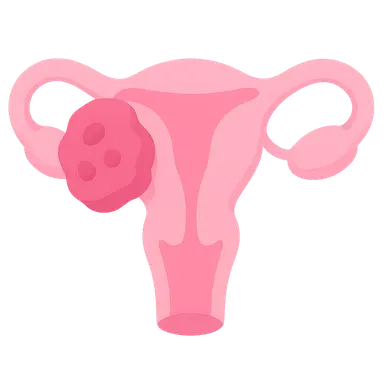 Vulvar and Vaginal Cancer