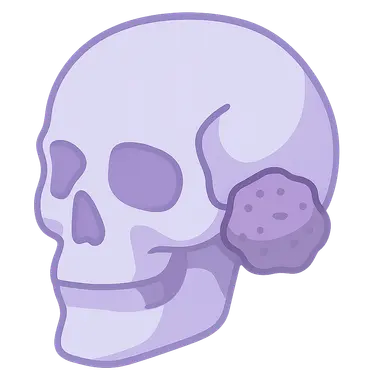 Meningiomas of the Skull Base