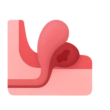 Hernia complications