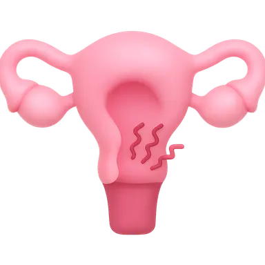 Secondary Dysmenorrhea