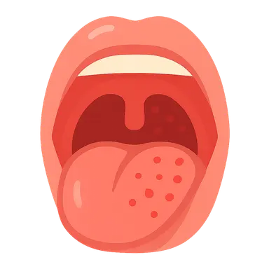 Pharyngitis