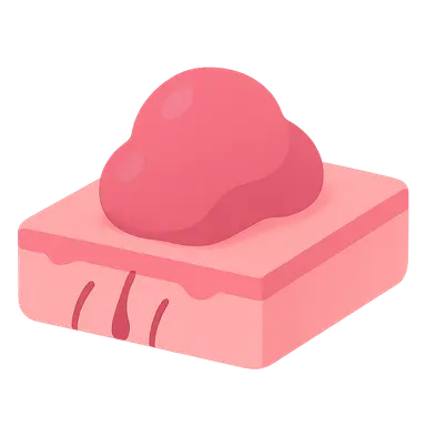 Dermal tumors and proliferations