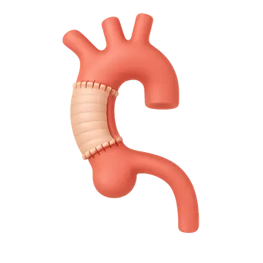 Aortic dissection management