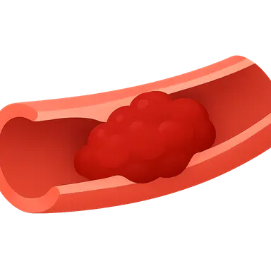 Thromboembolic disease