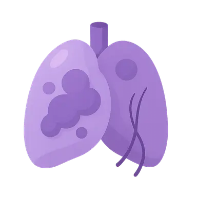 Paraneoplastic syndromes