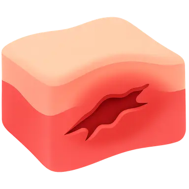 Soft Tissue Injuries