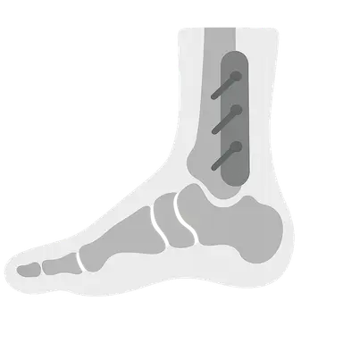 Reconstructive Procedures