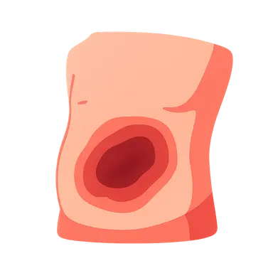 Blunt abdominal trauma