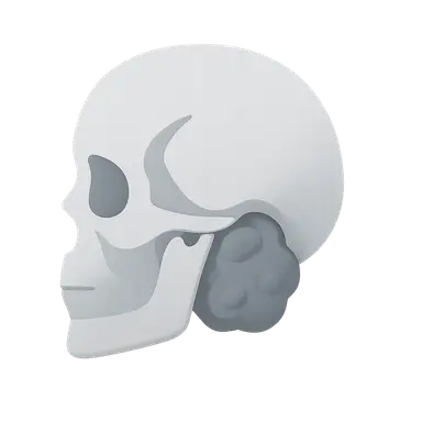 Skull Base Chordomas and Chondrosarcomas