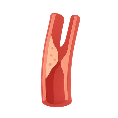 Peripheral arterial disease diagnosis and management