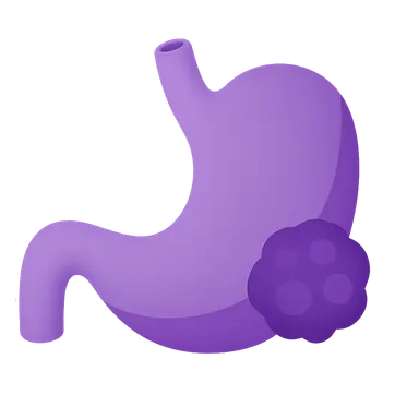 Principles of Surgical Oncology