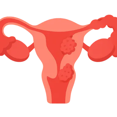 Pelvic Inflammatory Disease