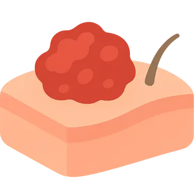 Infantile Hemangiomas and Vascular Malformations