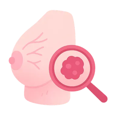 Breast Cancer: Diagnosis and Staging