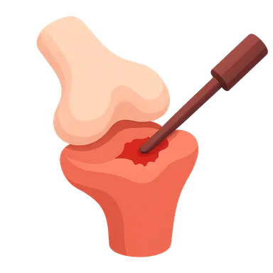 Complications in Arthroscopy