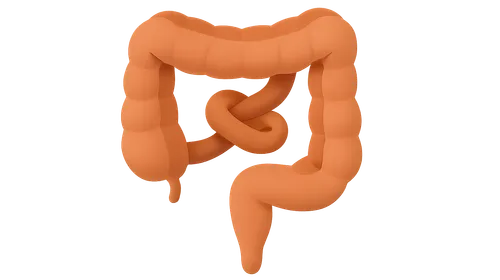 Bowel obstruction
