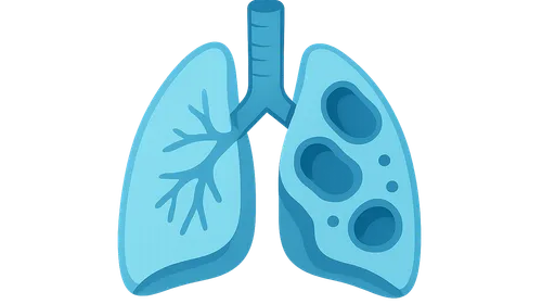 COPD diagnosis and exacerbations