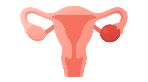 Ectopic pregnancy