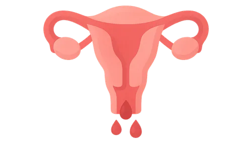 Abnormal uterine bleeding