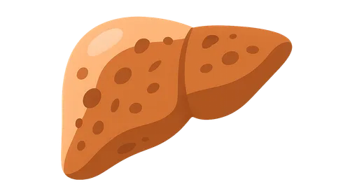 Cirrhosis and complications