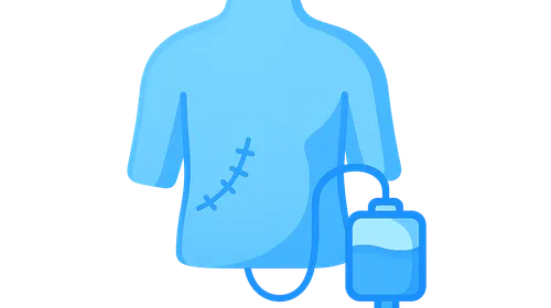 Enhanced Recovery After Surgery (ERAS) Protocols