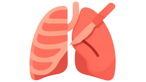 Thoracotomy approaches and techniques