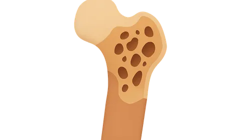 Metabolic bone disease
