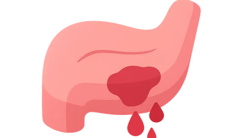 Postoperative bleeding