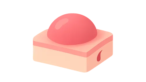 Skin Lesions: Morphology and Description