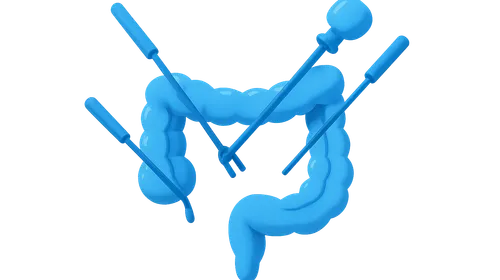 Laparoscopic Colorectal Surgery