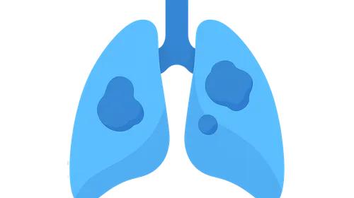 Acute Respiratory Distress Syndrome