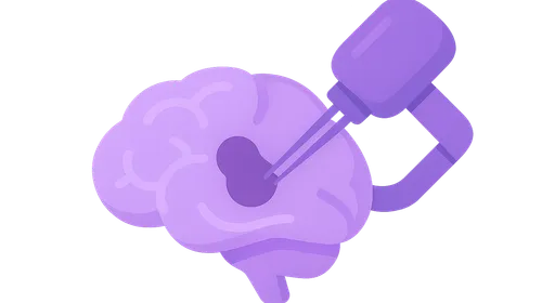 Stereotactic Radiosurgery