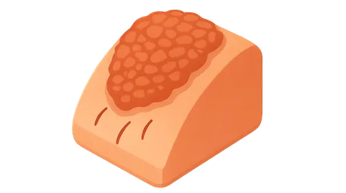 Lichen Simplex Chronicus