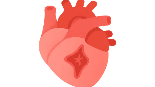 Valvular heart disease and heart failure